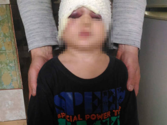 Прокуратура организовала проверку по факту избиения 3-летнего мальчика в Волжском