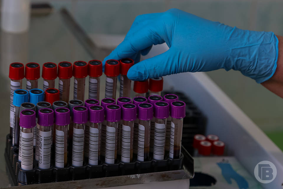 Санврачи ответят на вопросы волгоградцев о ВИЧ и СПИД