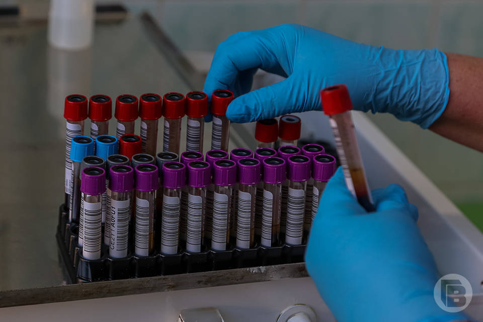 Волгоградцам рассказали о способах профилактики вирусного гепатита С