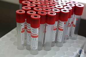 Фото: Дмитрий Рогулин / "Городские вести"